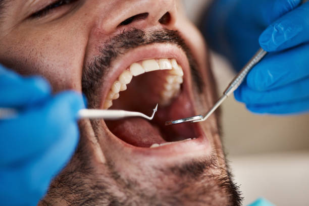 Best Cosmetic Dentistry  in Roanoke, IN